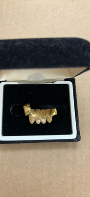 Gold Teeth - Image 1 of 4